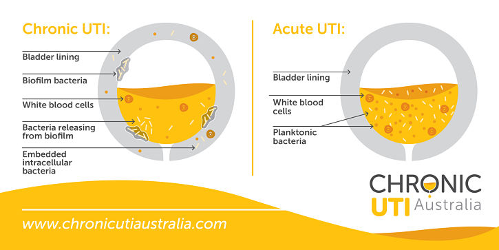 chronic-urinary-tract-infection-versus-acute-urinary-tract-infection