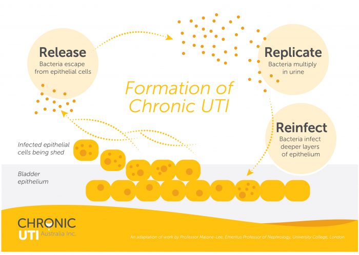 What Is Chronic Urinary Tract Infection (UTI) - Chronic UTI Australia